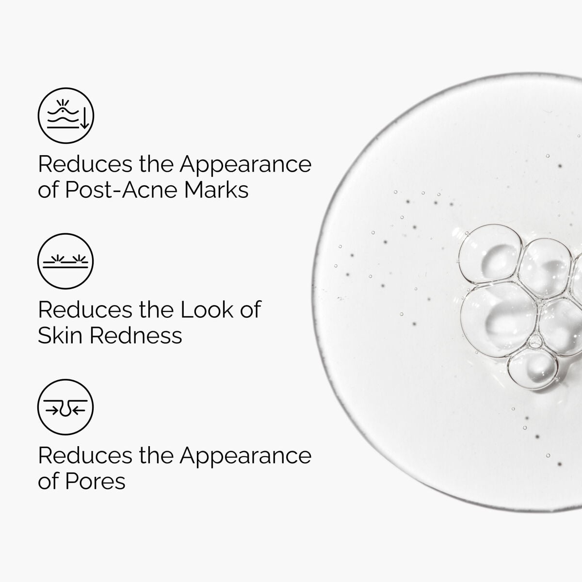 Aloe 2% + NAG 2% Solution - Gentle Reset