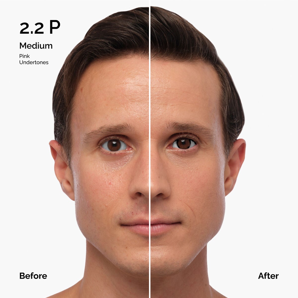 Serum - 1.0-n - 30ml - Easy Blend
