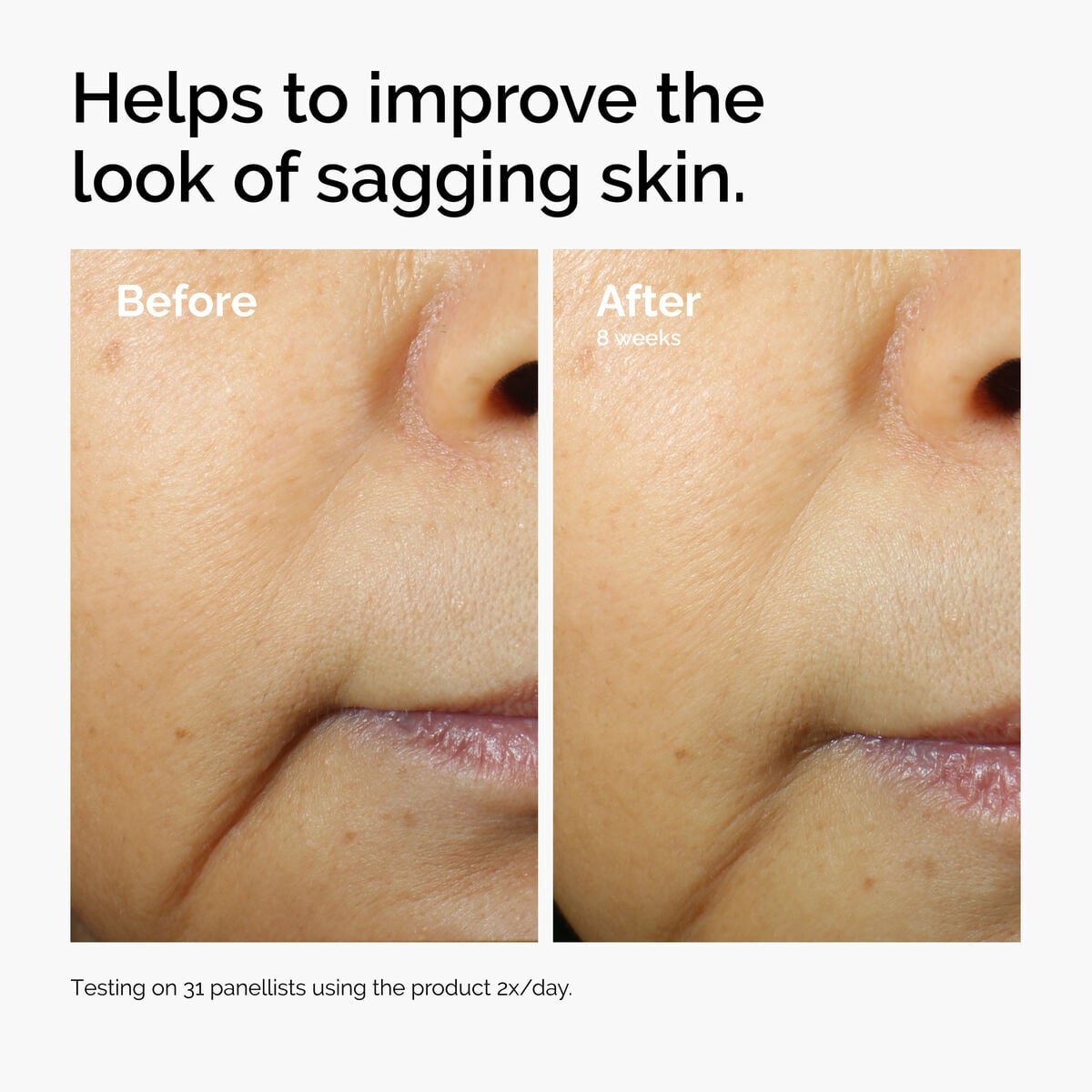 3% + Escin 1% Face Serum - Clear Balance