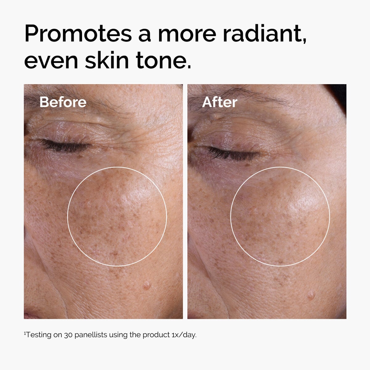 Acid 7% Exfoliating Toner - Essential Set