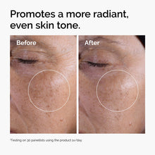 Acid 7% Exfoliating Toner - Essential Set