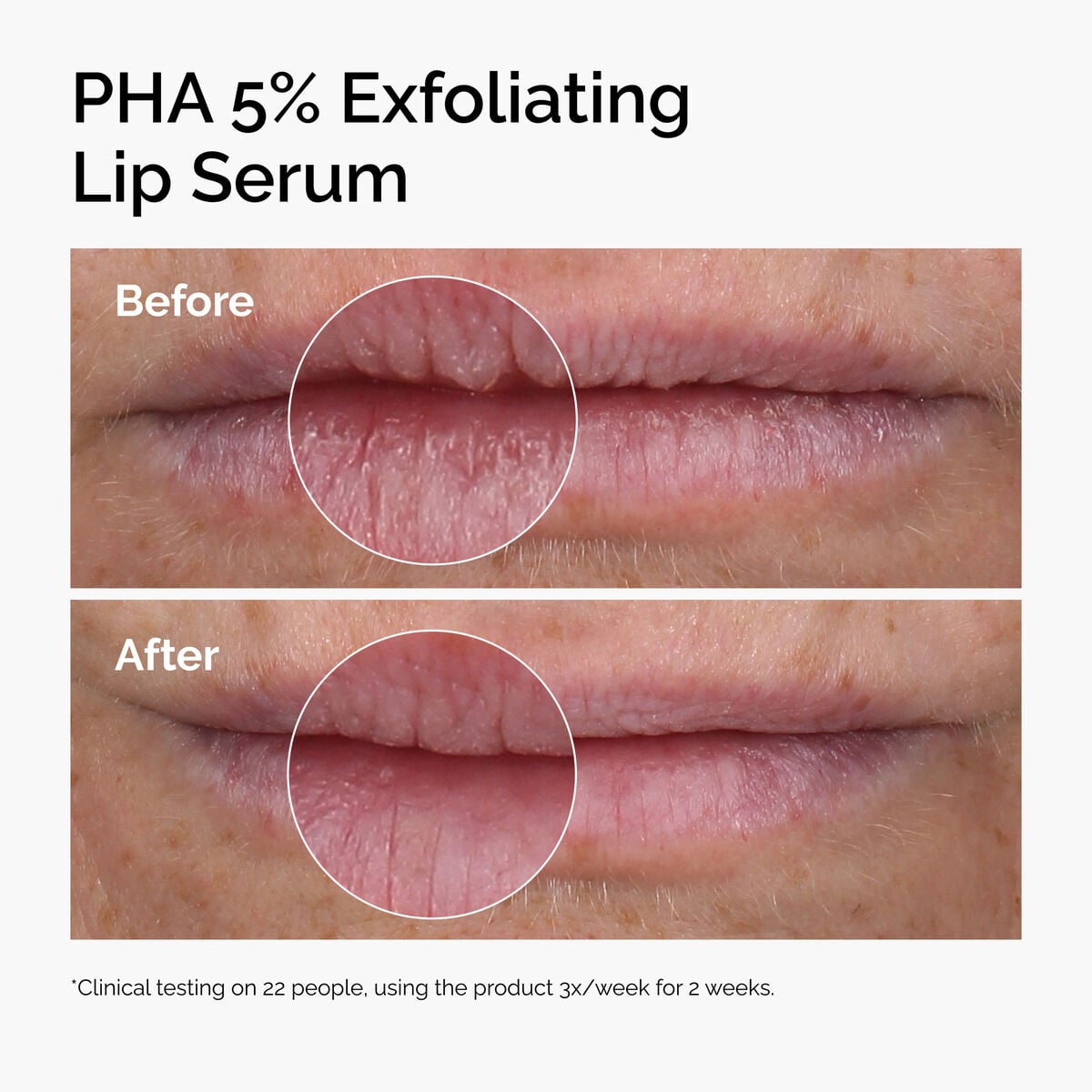 PHA 5% Exfoliating Lip Serum - Soft Focus