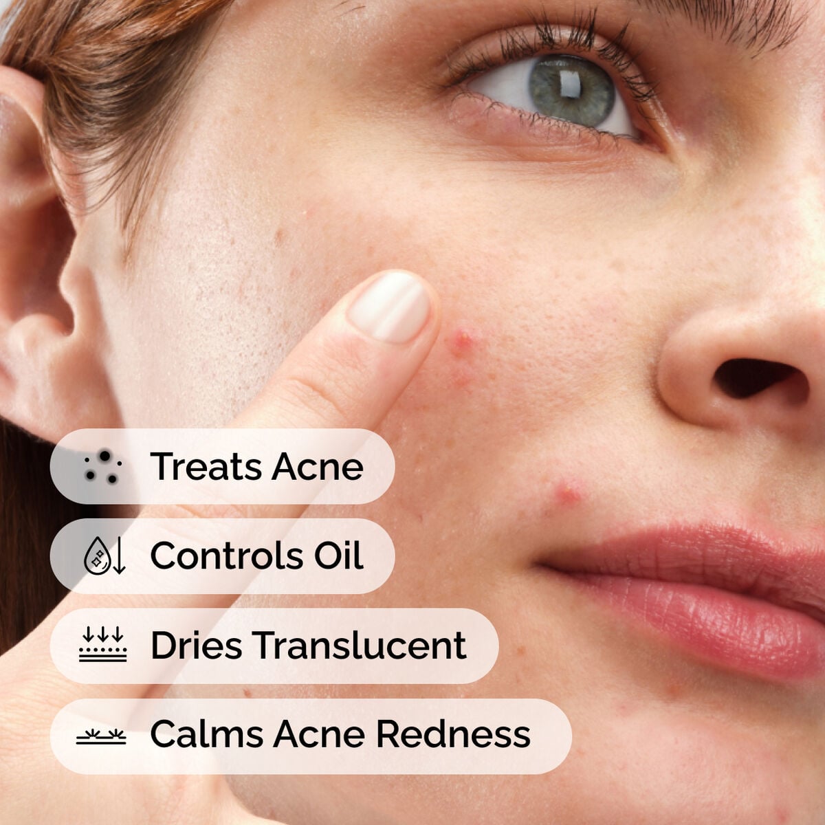 Sulfur 10% Powder-to-Cream Concentrate - Clean Comfort