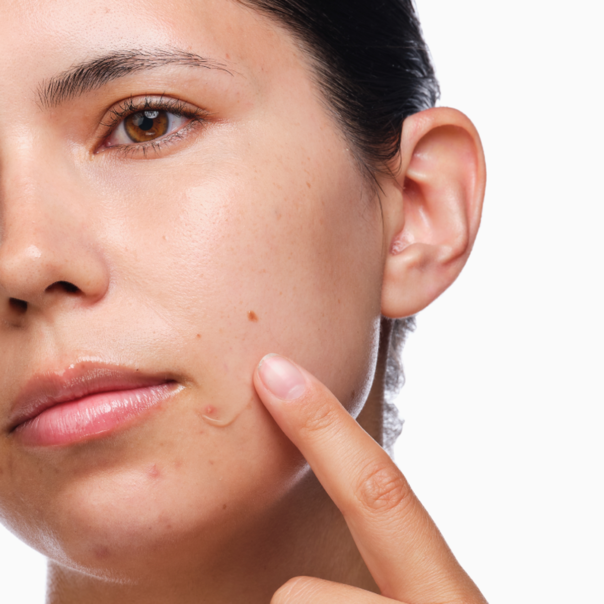 The Acne Set - Ready Routine