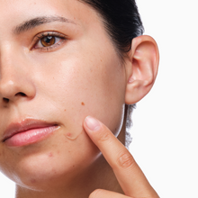 The Acne Set - Ready Routine